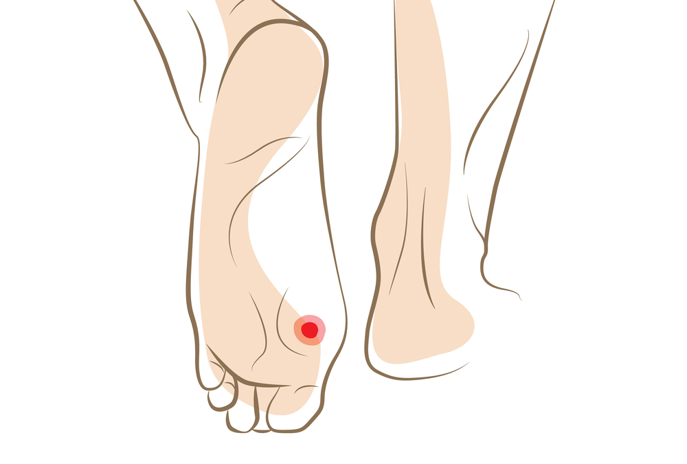 Why You Should Never Let a Foot Infection Go Untreated